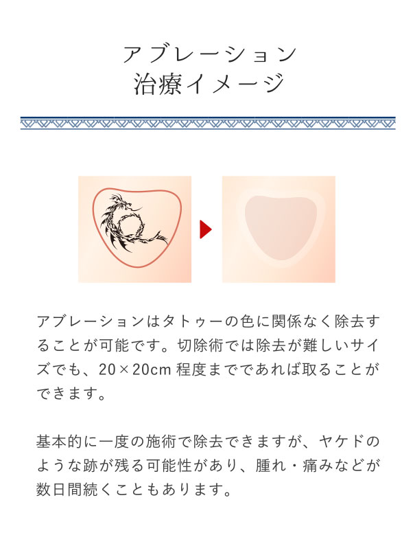 ablation2