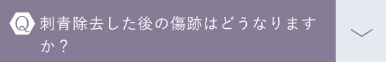 faq4