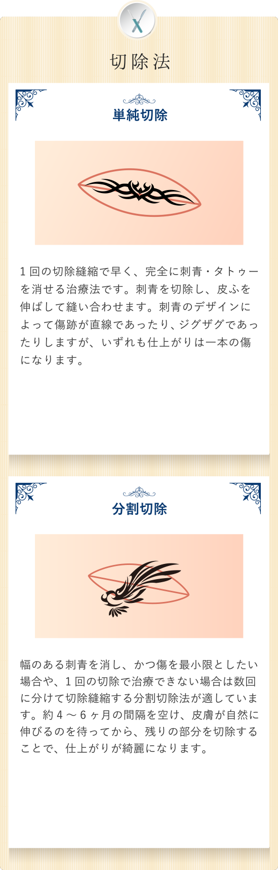 way