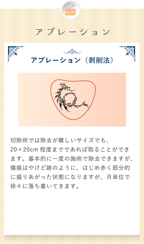 way